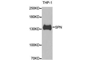 Western blot analysis of extracts of THP-1 cells, using SPN antibody. (CD43 anticorps  (AA 276-400))