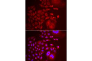 Immunofluorescence analysis of U2OS cells using TRAPPC10 antibody (ABIN5974105). (TRAPPC10 anticorps)
