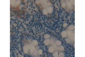 Used in DAB staining on fromalin fixed paraffin- embedded rectum tissue (PA2G4 anticorps  (AA 2-394))