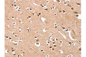 The image on the left is immunohistochemistry of paraffin-embedded Human brain tissue using ABIN7190421(CYP46A1 Antibody) at dilution 1/15, on the right is treated with synthetic peptide. (CYP46A1 anticorps)