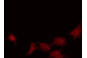 ABIN6267243 staining HuvEc by IF/ICC.