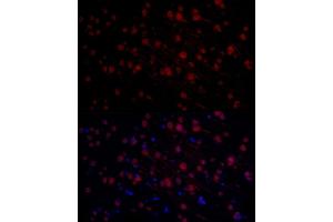 Immunofluorescence analysis of rat brain using MYCN Rabbit pAb (ABIN1680957, ABIN3015161, ABIN3015163 and ABIN6213865) at dilution of 1:50 (40x lens).
