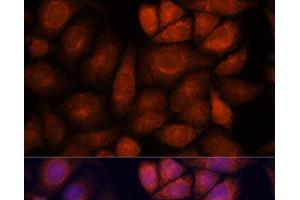 Immunofluorescence analysis of HeLa cells using KIF13A Polyclonal Antibody at dilution of 1:100. (KIF13A anticorps)