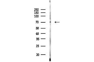 anti-Kelch Repeat and BTB (POZ) Domain Containing 3 (KBTBD3) (C-Term) antibody