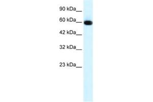 Western Blotting (WB) image for anti-GLIS Family Zinc Finger 2 (GLIS2) antibody (ABIN2460154) (GLIS2 anticorps)