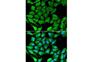 Immunofluorescence analysis of A549 cell using PPARG antibody.