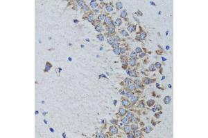 Immunohistochemistry of paraffin-embedded rat brain using PTPN1 antibody. (PTPN1 anticorps)