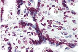 Human Placenta: Formalin-Fixed, Paraffin-Embedded (FFPE) (Aryl Hydrocarbon Receptor anticorps  (AA 279-376))