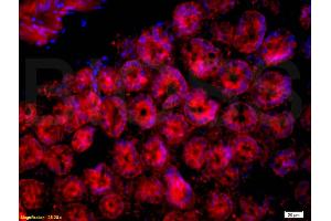 Formalin-fixed and paraffin-embedded mouse intestine labeled with Anti-CD33/Siglec-3 Polyclonal Antibody, Unconjugated (ABIN687607) 1:200, overnight at 4°C, The secondary antibody was Goat Anti-Rabbit IgG, Cy3 conjugated used at 1:200 dilution for 40 minutes at 37°C.
