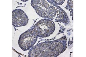 IHC testing of FFPE rat testis tissue with GSTM3 antibody at 1ug/ml. (GSTM3 anticorps)