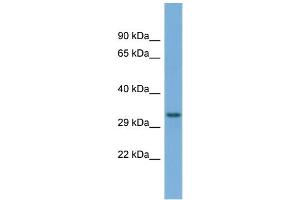 Host:  Rabbit  Target Name:  T Sample Type:  OVCAR-3 Whole Cell lysates  Antibody Dilution:  1. (TAM41 anticorps  (C-Term))