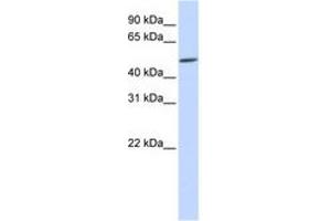 Image no. 1 for anti-Homeobox even-skipped homolog protein 2 (EVX2) (C-Term) antibody (ABIN6740651) (EVX2 anticorps  (C-Term))