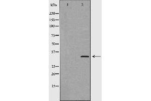 Western blot analysis of Cyclin D2 (Phospho-Thr280) expression in 293 cells.