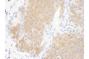 Immunohistochemistry (IHC) image for anti-Chaperonin Containing TCP1, Subunit 3 (Gamma) (CCT3) (AA 300-350) antibody (ABIN7453614)