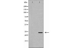 Western blot analysis of HepG2 cell lysate, using ORM1 Antibody. (ORM1 anticorps  (Internal Region))