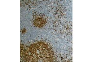 Immunohistochemistry (IHC) image for anti-Paired Box 5 (PAX5) antibody (ABIN2667347)