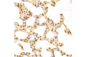 Immunohistochemistry of paraffin-embedded rat lung using SRSF1 Antibody (ABIN5970815) at dilution of 1/100 (40x lens). (SRSF1 anticorps)
