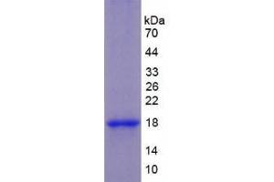 SDS-PAGE analysis of Human Keratin 1 Protein. (Cytokeratin 1 Protéine)