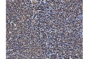 IHC analysis of TIP49A/RUVBL1 using anti-TIP49A/RUVBL1 antibody (ABIN7599928). (RUVBL1 anticorps  (AA 13-23))