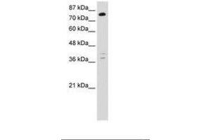 Image no. 1 for anti-TSC22 Domain Family, Member 2 (TSC22D2) (C-Term) antibody (ABIN6736248) (TSC22D2 anticorps  (C-Term))