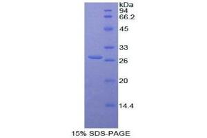 SDS-PAGE (SDS) image for Catenin, beta (CATNB) (AA 439-675) protein (His tag) (ABIN1879261)