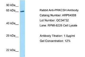 Western Blotting (WB) image for anti-Protein Kinase C Substrate 80K-H (PRKCSH) (N-Term) antibody (ABIN2789692) (PRKCSH anticorps  (N-Term))