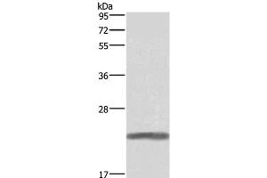 Western Blot analysis of Human placenta tissue using GH1 Polyclonal Antibody at dilution of 1:500 (Growth Hormone 1 anticorps)