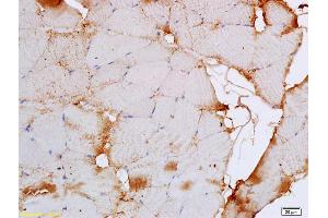 Formalin-fixed and paraffin embedded rat skeletal muscle labeled with Rabbit Anti CACNA1S Polyclonal Antibody, Unconjugated (ABIN1387901) at 1:200 followed by conjugation to the secondary antibody and DAB staining