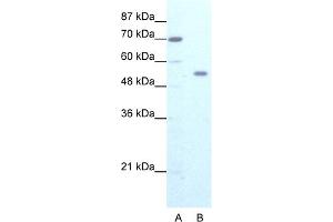 WB Suggested Anti-ZNF665 Antibody Titration:  1. (ZNF665 anticorps  (N-Term))