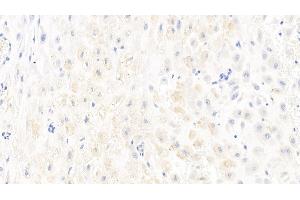 Detection of CASP1 in Human Placenta Tissue using Polyclonal Antibody to Caspase 1 (CASP1)