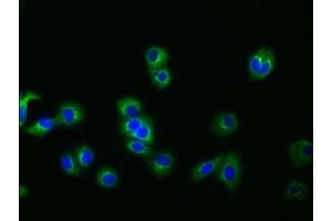 Immunofluorescence staining of HepG2 cells with ABIN7127519 at 1:30, counter-stained with DAPI. (Recombinant Glypican 3 anticorps)