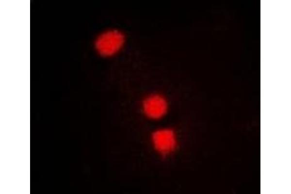 SMCHD1 anticorps