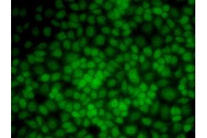 Immunofluorescence analysis of HeLa cells using UMPS antibody (ABIN5973202). (UMPS anticorps)