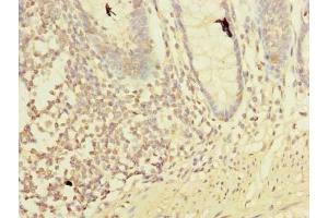 Immunohistochemistry of paraffin-embedded human colon tissue using ABIN7158359 at dilution of 1:100