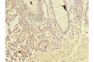 Immunohistochemistry of paraffin-embedded human colon tissue using ABIN7158359 at dilution of 1:100 (LMO3 anticorps  (AA 1-145))