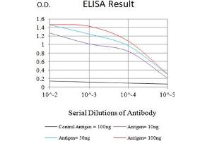 Black line: Control Antigen (100 ng),Purple line: Antigen (10 ng), Blue line: Antigen (50 ng), Red line:Antigen (100 ng)