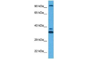 Host:  Rabbit  Target Name:  ZFX  Sample Tissue:  Human HT1080 Whole Cell  Antibody Dilution:  1ug/ml (ZFX anticorps  (N-Term))