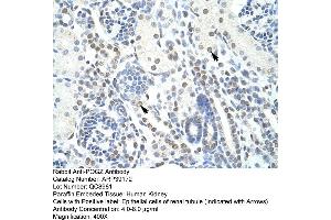 Human kidney (POGZ anticorps  (N-Term))