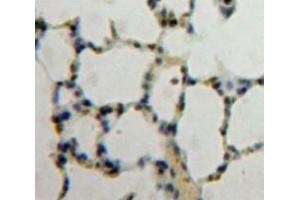 IHC-P analysis of Lung tissue, with DAB staining. (NUP88 anticorps  (AA 476-713))