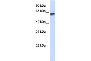 WB Suggested Anti-PHGDH Antibody Titration: 0. (PHGDH anticorps  (Middle Region))