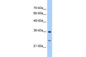 WB Suggested Anti-GSTZ1 Antibody Titration:  2. (GSTZ1 anticorps  (N-Term))