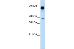 Western Blotting (WB) image for anti-Pseudouridylate Synthase 7 Homolog (PUS7) antibody (ABIN2462966) (PUS7 anticorps)