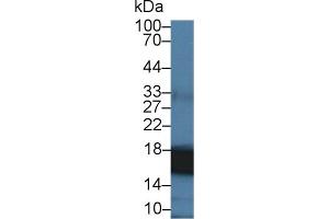 Detection of CYPA in Human Liver lysate using Polyclonal Antibody to Cyclophilin A (CYPA)