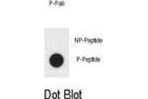 Dot blot analysis of Phospho-BAD-S57 Antibody Phospho-specific Pab (ABIN1881101 and ABIN2850458) on nitrocellulose membrane. (BAD anticorps  (pSer57))