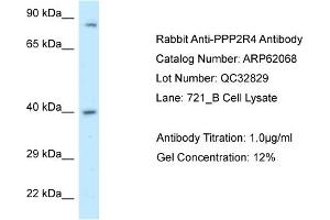 Western Blotting (WB) image for anti-Protein Phosphatase 2A Activator, Regulatory Subunit 4 (PPP2R4) (C-Term) antibody (ABIN2789006) (PPP2R4 anticorps  (C-Term))