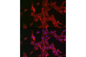 Immunofluorescence analysis of PC-12 cells using B Rabbit pAb (ABIN6129899, ABIN6136816, ABIN6136817 and ABIN6222589) at dilution of 1:100 (40x lens). (ALOX15B anticorps  (AA 1-200))