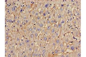 Immunohistochemistry of paraffin-embedded human liver tissue using ABIN7171513 at dilution of 1:100 (TOM1 anticorps  (AA 306-487))