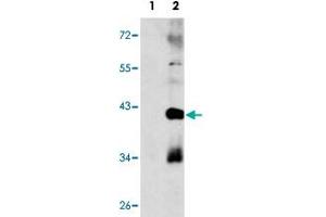 Western blot analysis of MAPK11 (arrow) using MAPK11 polyclonal antibody . (MAPK11 anticorps  (Internal Region))