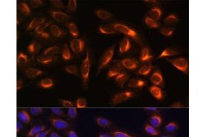 Immunofluorescence analysis of U-2 OS cells using PTCD1 Polyclonal Antibody at dilution of 1:100. (PTCD1 anticorps)