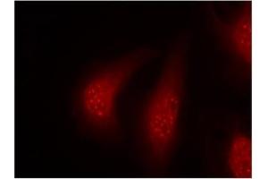 Image no. 1 for anti-Ribosomal Protein S6 Kinase, 90kDa, Polypeptide 1 (RPS6KA1) (pThr348) antibody (ABIN196796) (RPS6KA1 anticorps  (pThr348))